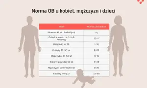 Tabela z normami OB (odczyn Biernackiego) dla noworodków, dzieci, kobiet i mężczyzn w różnym wieku.