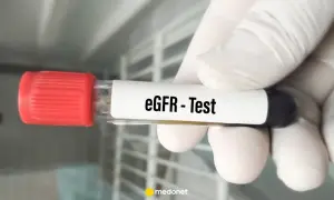Rękawiczka trzyma probówkę z napisem "eGFR - Test". Wynik eGFR jest kluczowy dla oceny pracy nerek.
