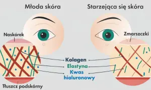 Niedobór kolagenu? Odkryj, co naprawdę działa na skórę i stawy