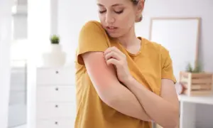 Alergia na pleśń objawy: od kataru po zmęczenie. Kiedy do lekarza?