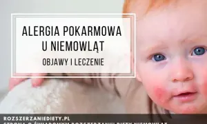 Alergia pokarmowa: objawy. Jak rozpoznać i kiedy działać?