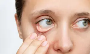 Niedobór żelaza: objawy, diagnoza i leczenie. Kiedy do lekarza?