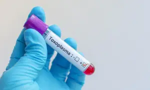 Rękawiczka w niebieskiej rękawiczce trzyma probówkę z krwią do badań na toksoplazmozę. Wynik jest pozytywny.