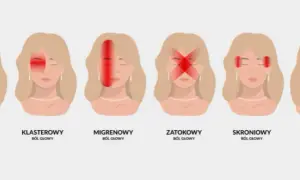 Ból z tyłu głowy sygnał alarmowy czy stres? Poznaj przyczyny
