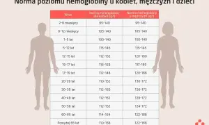 Tabela przedstawia normę hemoglobiny dla kobiet, mężczyzn i dzieci w zależności od wieku.