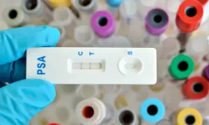 Rękawiczka trzyma test PSA z dwoma paskami, wskazującymi wynik. W tle widać probówki.