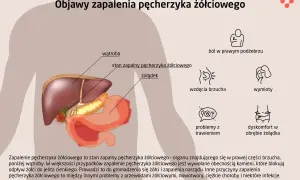 Anatomia i objawy zapalenia pęcherzyka żółciowego: ból, wzdęcia, wymioty, problemy z trawieniem.