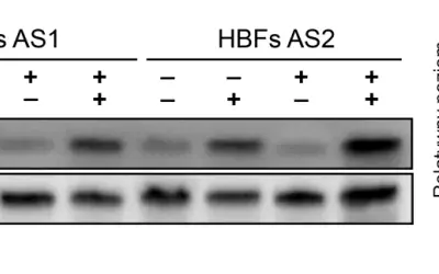 Western blot pokazujący poziom fosforylacji Smad1/5/9 w komórkach HBFs AS1 i AS2 po traktowaniu TGF-β₁ i ISL.