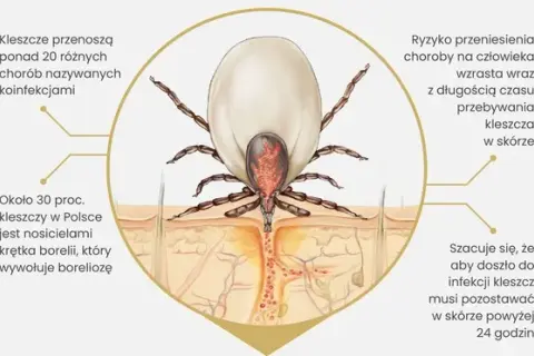 Kleszcz i borelioza: Kiedy badać, by wynik był pewny?