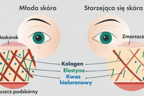 Niedobór kolagenu? Odkryj, co naprawdę działa na skórę i stawy