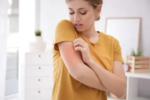 Alergia na pleśń objawy: od kataru po zmęczenie. Kiedy do lekarza?