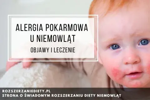 Alergia pokarmowa: objawy. Jak rozpoznać i kiedy działać?