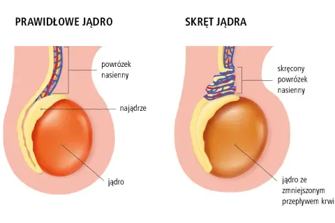 Ból jądra: Jaki lekarz? Kiedy liczy się każda minuta?