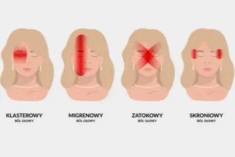 Ból z tyłu głowy sygnał alarmowy czy stres? Poznaj przyczyny
