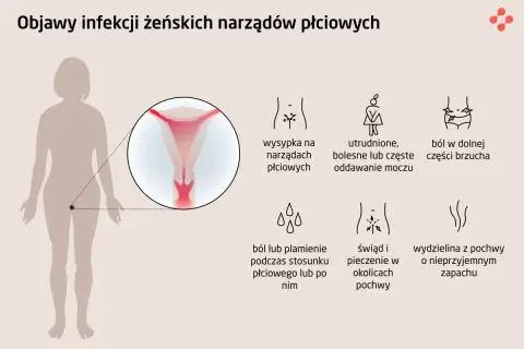 Objawy infekcji narządów płciowych: wysypka, ból brzucha, problemy z oddawaniem moczu, świąd, pieczenie, ból podczas seksu. Choroby weneryczne mogą objawiać się podobnie.