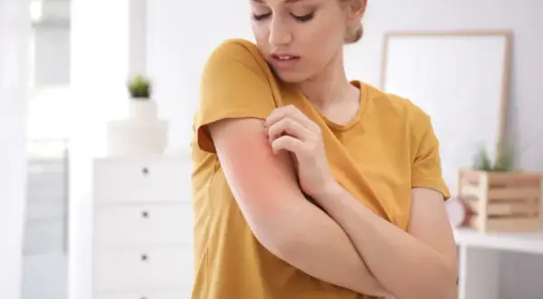 Alergia na pleśń objawy: od kataru po zmęczenie. Kiedy do lekarza?