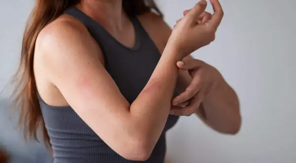 Alergia na kurz i roztocza: Jakie leki wybrać? Odczulanie
