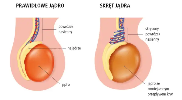 Ból jądra: Jaki lekarz? Kiedy liczy się każda minuta?
