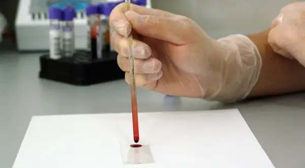 Ręka w rękawiczce pobiera próbkę krwi do badania. Cena hemoglobiny glikowanej jest kluczowa dla monitorowania cukrzycy.