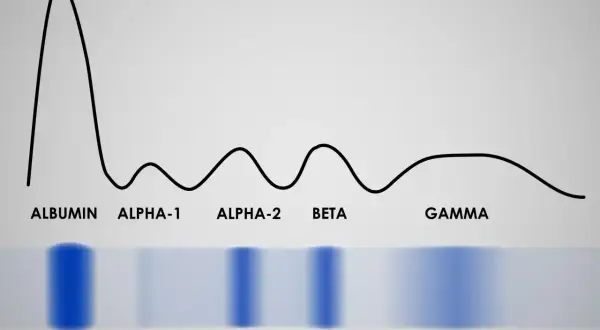 Wykres proteinogramu z frakcjami: albumina, alfa-1, alfa-2, beta, gamma. Widoczne pasma białek.