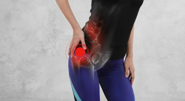 Ból biodra promieniuje? Co oznacza i kiedy iść do lekarza?
