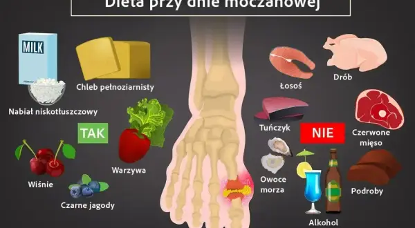 Dieta przy dnie moczanowej: TAK - nabiał, wiśnie, jagody, warzywa. NIE - czerwone mięso, podroby, alkohol. Milurit 100 może pomóc.