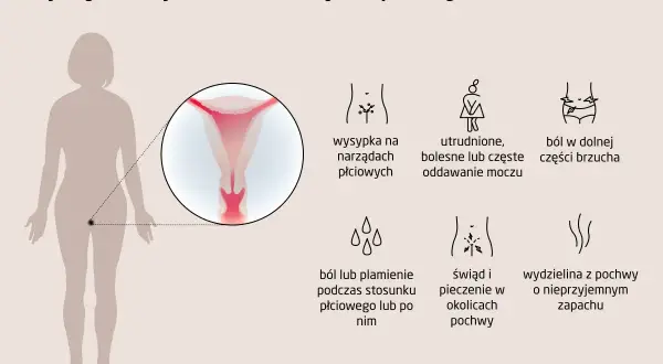 Objawy infekcji narządów płciowych: wysypka, ból brzucha, problemy z oddawaniem moczu, świąd, pieczenie, ból podczas seksu. Choroby weneryczne mogą objawiać się podobnie.