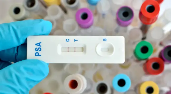 Rękawiczka trzyma test PSA z dwoma paskami, wskazującymi wynik. W tle widać probówki.
