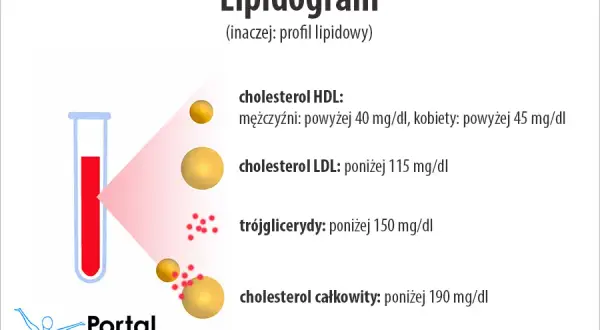 Wiarygodny lipidogram: Jak się przygotować? Uniknij błędów!