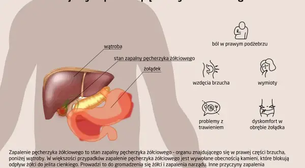 Anatomia i objawy zapalenia pęcherzyka żółciowego: ból, wzdęcia, wymioty, problemy z trawieniem.