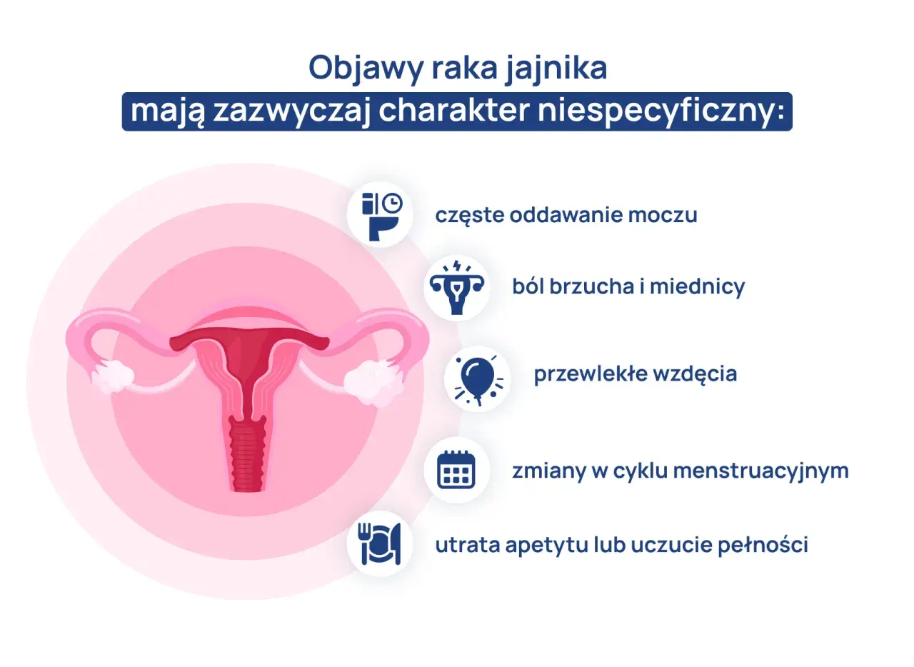 Grafika przedstawia narządy rodne kobiety i objawy raka jajnika: ból brzucha, częste oddawanie moczu, wzdęcia, zmiany cyklu, utratę apetytu. Test Roma może pomóc w diagnostyce.