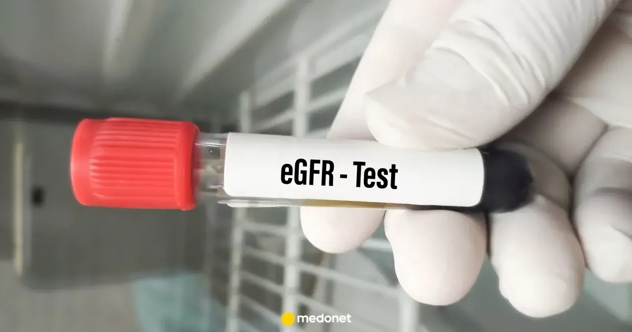 Rękawiczka trzyma probówkę z napisem "eGFR - Test". Wynik eGFR jest kluczowy dla oceny pracy nerek.