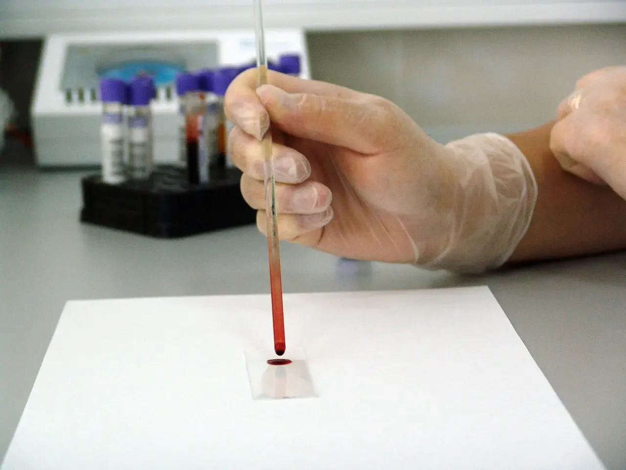 Ręka w rękawiczce pobiera próbkę krwi do badania. Cena hemoglobiny glikowanej jest kluczowa dla monitorowania cukrzycy.