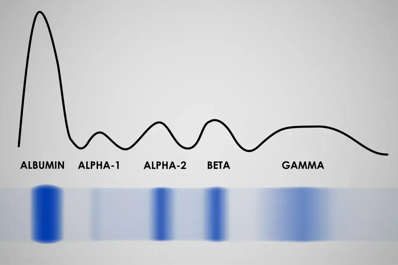 Wykres proteinogramu z frakcjami: albumina, alfa-1, alfa-2, beta, gamma. Widoczne pasma białek.