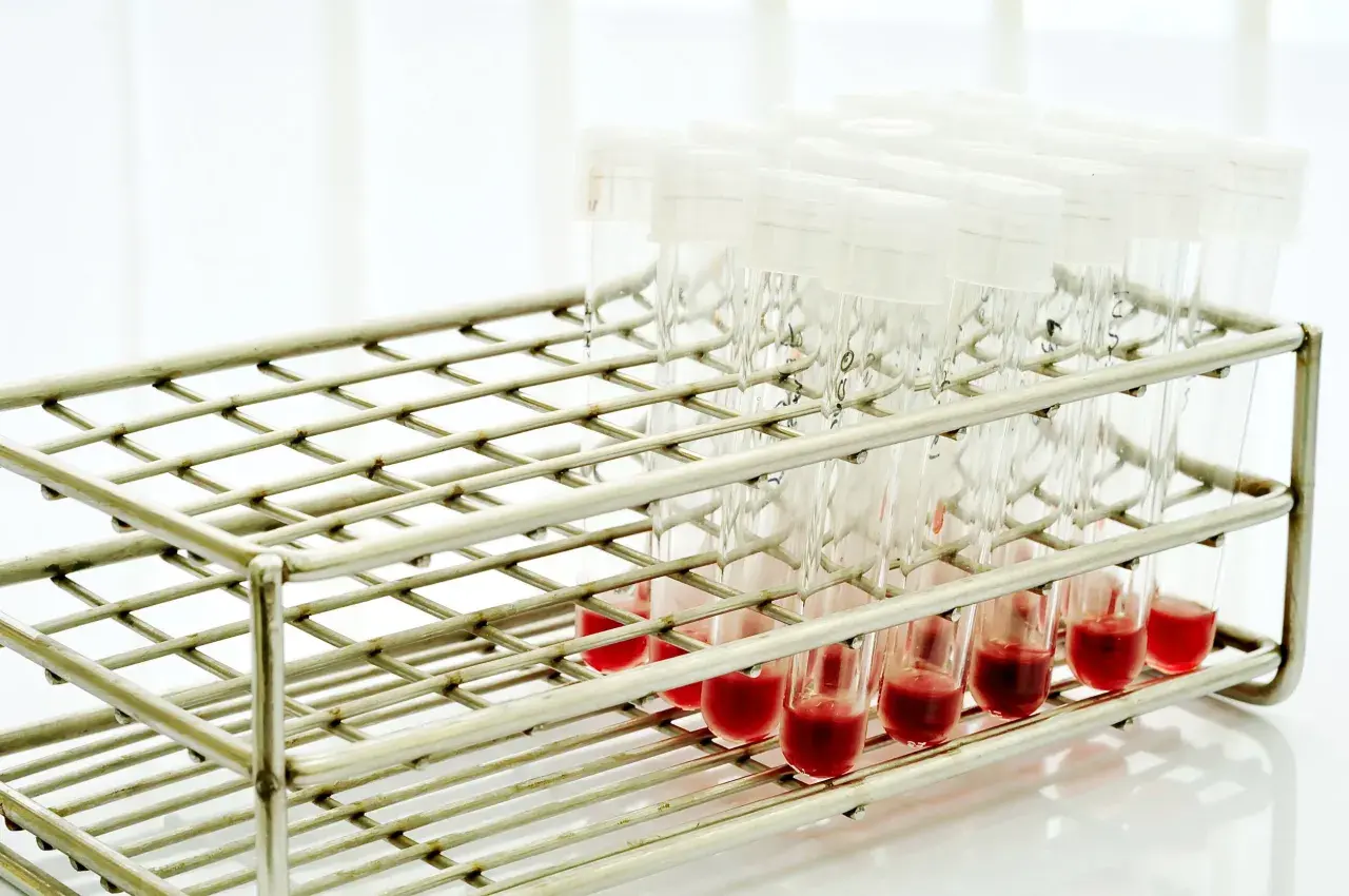 Rząd probówek z czerwoną surowicą w metalowym stojaku laboratoryjnym.