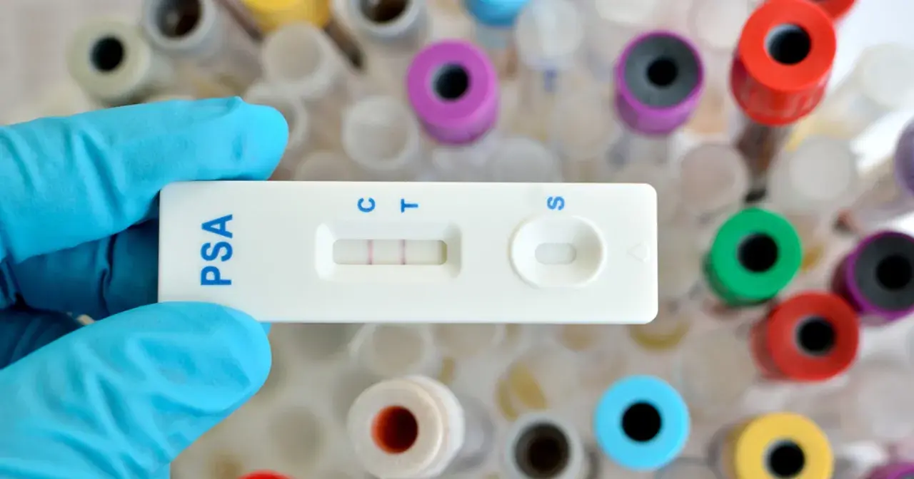 Rękawiczka trzyma test PSA z dwoma paskami, wskazującymi wynik. W tle widać probówki.