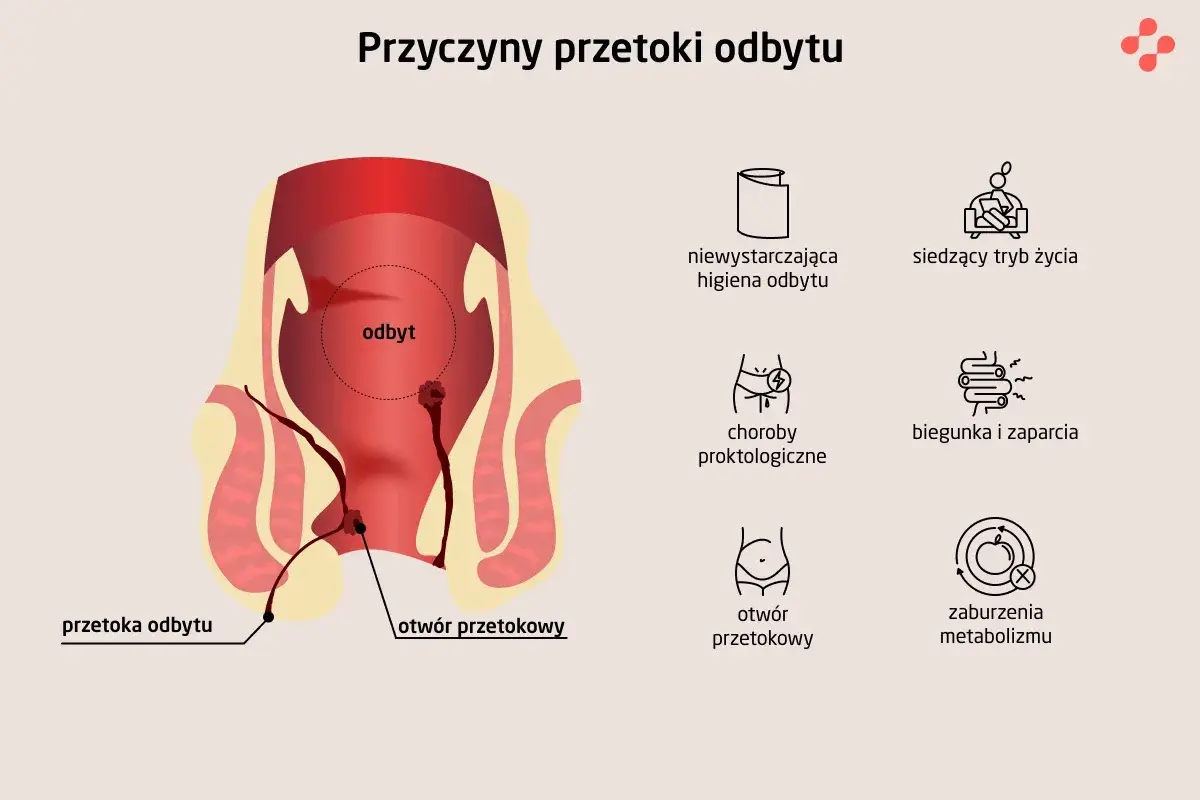 Ilustracja przedstawia anatomię odbytu z widoczną przetoką odbytu. Obok ikony symbolizujące przyczyny: zła higiena, siedzący tryb życia, choroby proktologiczne, biegunka i zaparcia, otwór przetokowy, zaburzenia metabolizmu.