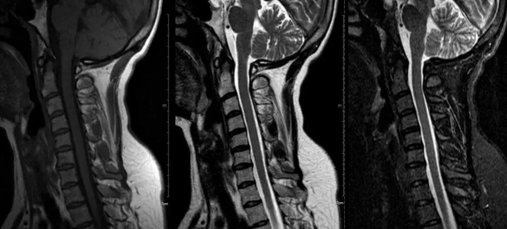 porównanie obrazów rtg tk mri