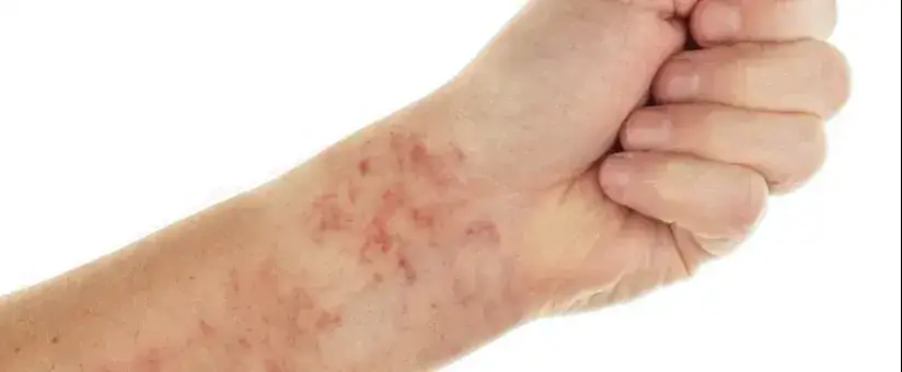 badania diagnostyczne ból kości swędzenie skóry