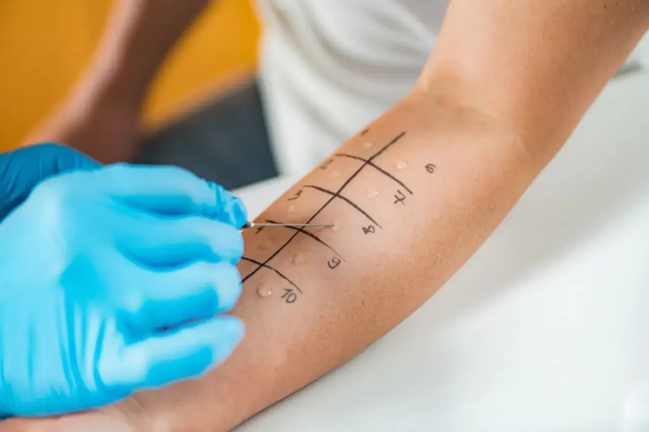 immunoterapia alergia odczulanie
