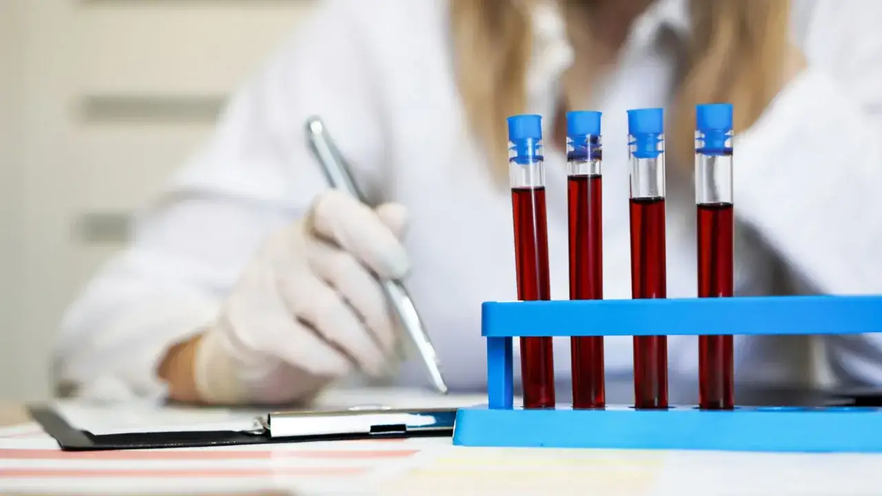 badanie krwi INR laboratorium