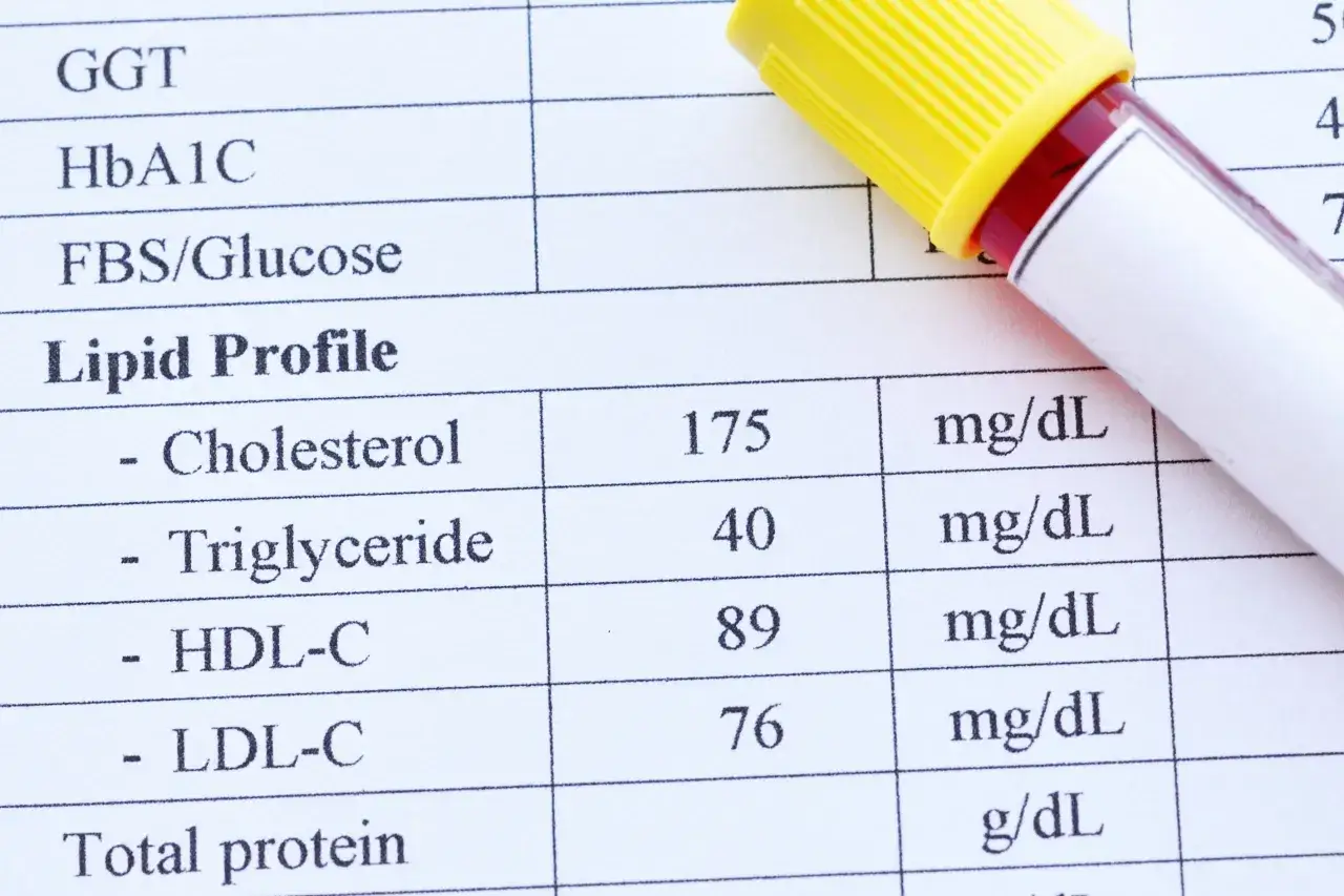Wynik lipidogramu: cholesterol 175, trójglicerydy 40, HDL-C 89, LDL-C 76. Wynik LDL-C jest w normie.