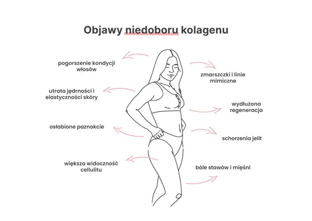 objawy niedoboru kolagenu skóra stawy