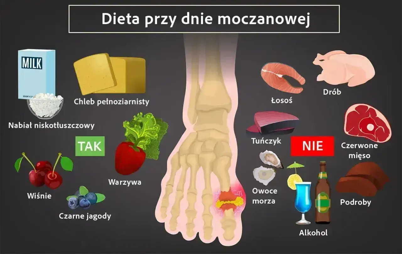 Dieta przy dnie moczanowej: TAK - nabiał niskotłuszczowy, chleb pełnoziarnisty, warzywa, wiśnie, czarne jagody. NIE - tuńczyk, owoce morza, alkohol, podroby, czerwone mięso.