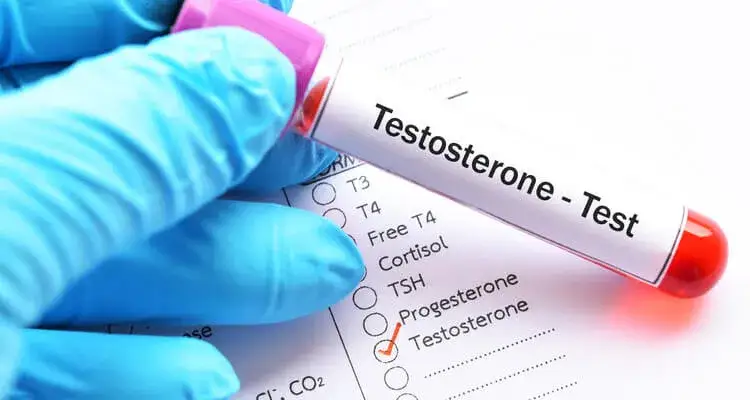 Badanie poziomu testosteronu krew