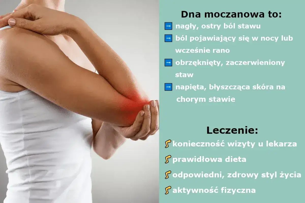 Dna moczanowa: objawy i leczenie. Ból stawu łokciowego, obrzęk, zaczerwienienie. Leczenie: wizyta u lekarza, dieta, styl życia, aktywność fizyczna.