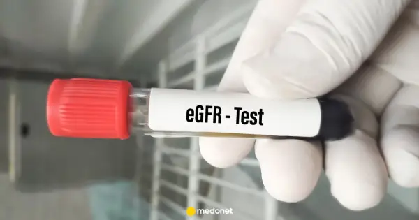 Rękawiczka trzyma probówkę z napisem "eGFR - Test". Wynik eGFR jest kluczowy dla oceny pracy nerek.