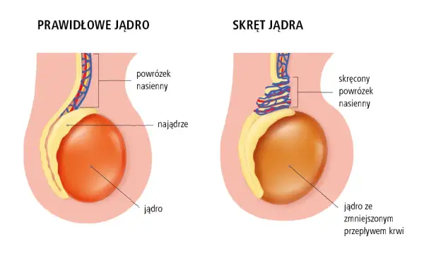 Ból jądra: Jaki lekarz? Kiedy liczy się każda minuta?