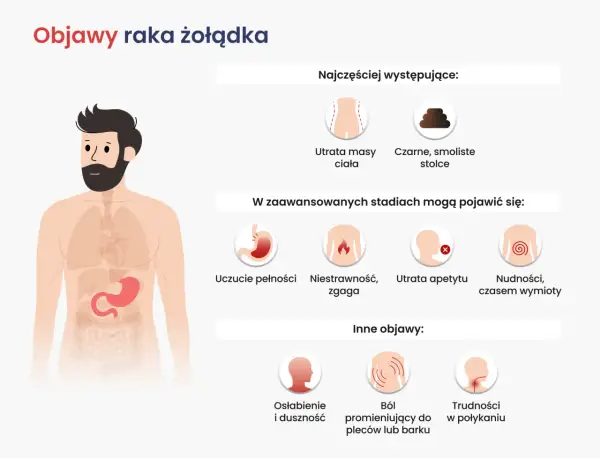 Objawy raka żołądka: utrata masy ciała, czarne stolce, uczucie pełności, niestrawność, zgaga, utrata apetytu, nudności, wymioty, osłabienie, ból pleców, trudności w połykaniu.