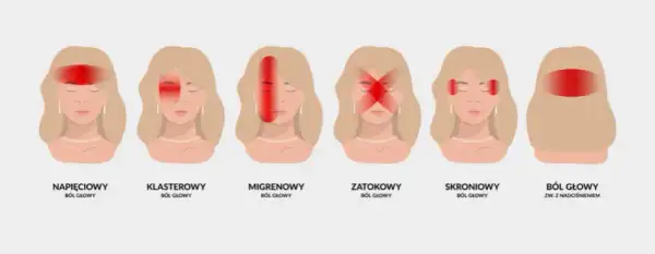 Ból z tyłu głowy sygnał alarmowy czy stres? Poznaj przyczyny